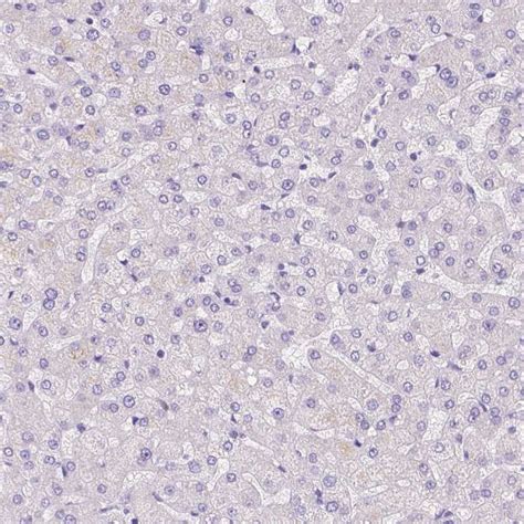 Motilin Antibody (PA5-64415)