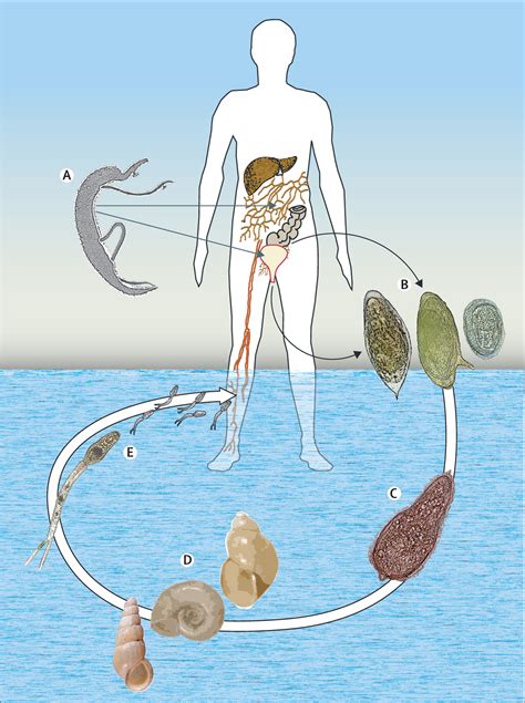 Human schistosomiasis - The Lancet