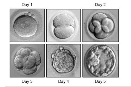 In Vitro Fertilization (IVF) | Fertility & Reproductive Medicine Center | Washington University ...