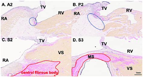 Histology of the right atrioventricular area. (A, B) The area between ...