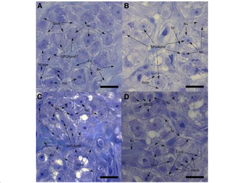 Identified spermatogonia types. Forty times magnification fields of ...