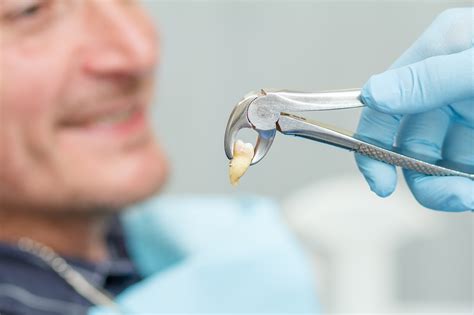 Tips for Tooth Extraction Medicine - Bellevue Pharmacy