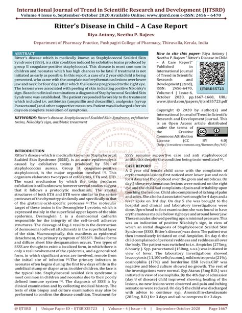 Ritter’s Disease in Child – A Case Report