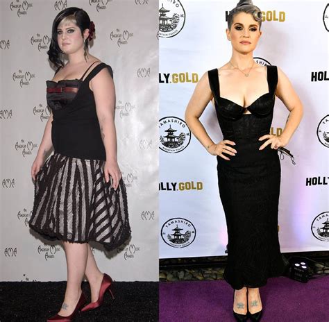 Kelly Osbourne: Weight Loss Story and Gastric Sleeve Surgery