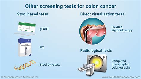 Slide Show - When should I get a colonoscopy and what do the results mean?