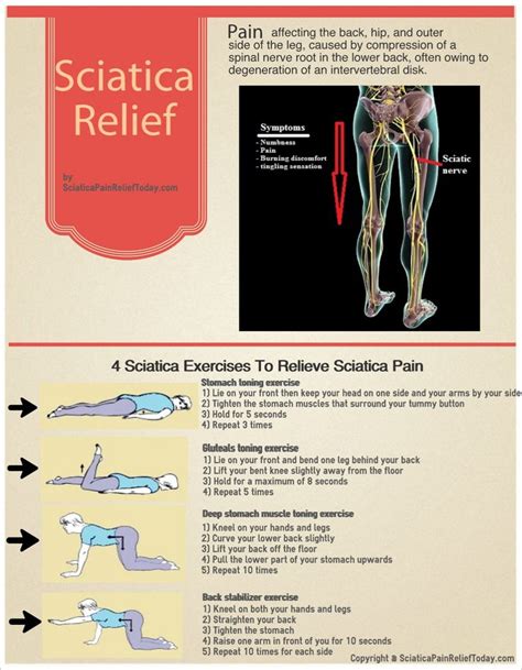 Levy H.: Exercises for sciatica pain mayo clinic