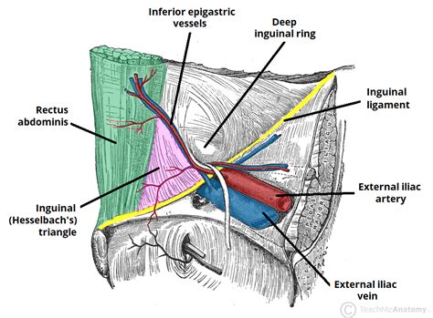 Inguinal (Hesselbach's) Triangle - Borders - Direct Hernia - TeachMeAnatomy