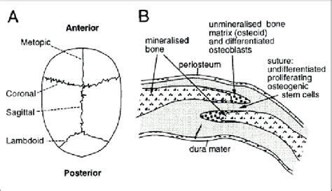 Normal cranial suture development. (A) View of child's skull from... | Download Scientific Diagram