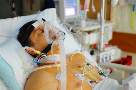 Mark in the ICU after open heart surgery. | The past few day… | Flickr