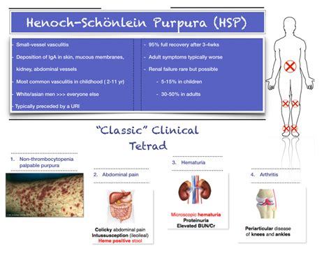 Henoch-Schonlein Purpura — NUEM Blog