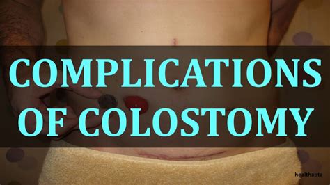 COMPLICATIONS OF COLOSTOMY - YouTube