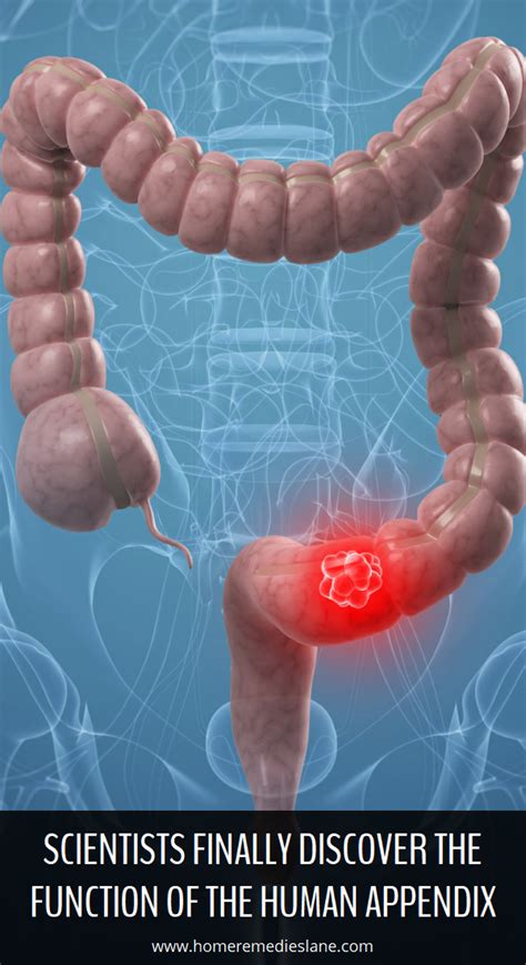 Scientists Finally Discover The Function of the Human Appendix | Remedies, Herbal remedies ...