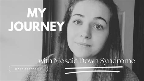 Mosaic Down Syndrome Diagnosis at 23 Years Old - YouTube