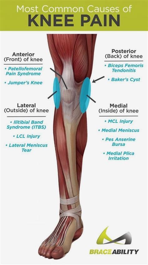 How Long Does It Take For An Mcl Sprain To Heal - Tim Berman Kapsels