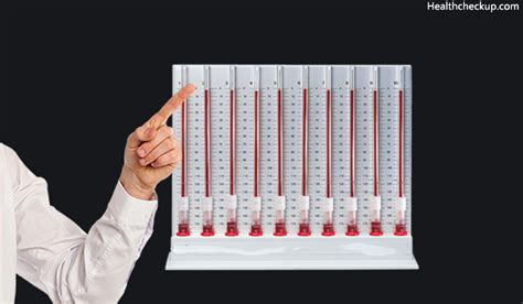 ESR Test Procedure, Normal Ranges and Causes of Low and High ESR