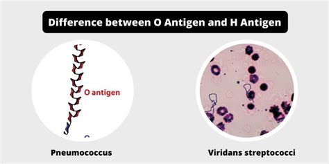 Difference between O antigen and H antigen - O vs H antigen - Biology ...