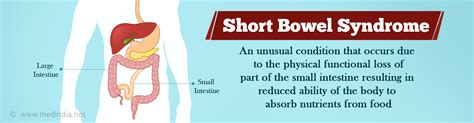 Short Bowel Syndrome - Causes, Symptoms, Complications, Diagnosis ...