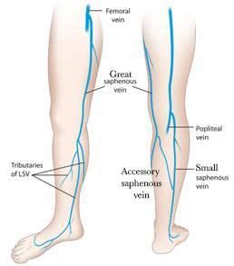 Greater and Lesser Saphenous Vein | Body anatomy, Interventional radiology, Sonography