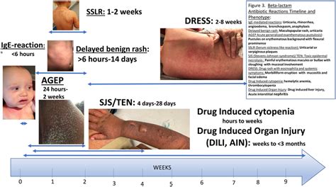 Beta-lactam antibiotic reactions timeline and phenotype: IgE-mediated... | Download Scientific ...