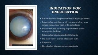 Enucleation of eye | PPT