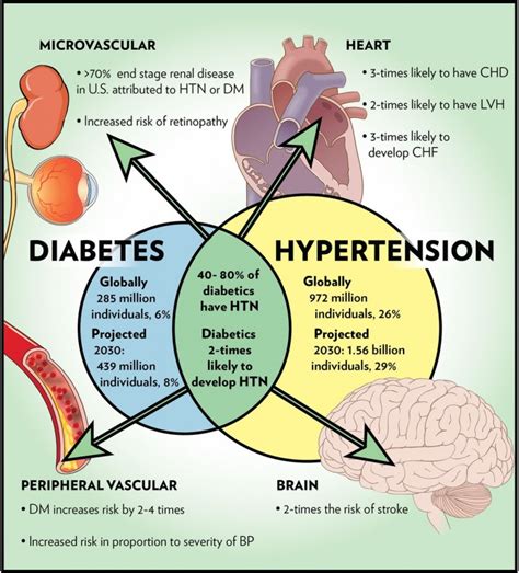 How Are Diabetes And Hypertension Linked? - Health | Katalay.net