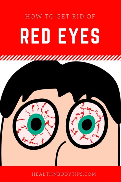 How to Get Rid of Red Eyes / Bloodshot Eyes?