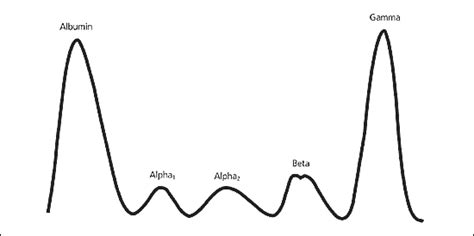 Understanding and Interpreting Serum Protein Electrophoresis | AAFP