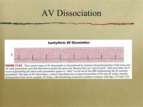 PPT - Wolff-Parkinson-White and Atrioventricular (AV) Heart Blocks PowerPoint Presentation - ID ...