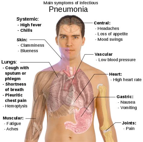 symptoms-of-pneumonia - Theayurveda