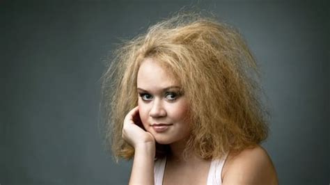 Do you have uncombable hair syndrome?