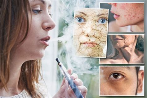 I'm a dermatologist - here's all the ways vaping is 'destroying your skin' from acne to wrinkles ...