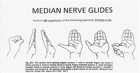 Median Nerve Glides Pdf