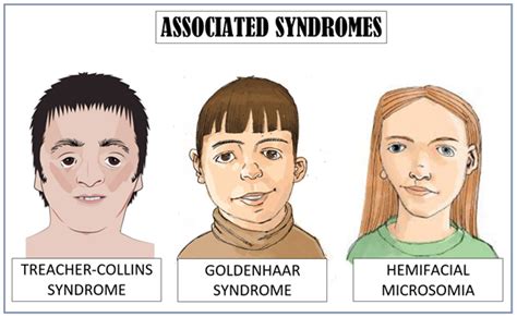 Microtia – Microtia Atresia Malaysia