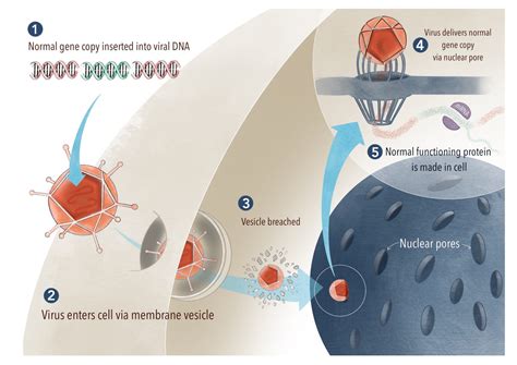 Gene therapy - Gene Vision