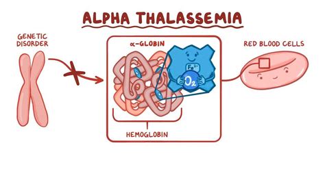 Alpha-thalassemia - Osmosis