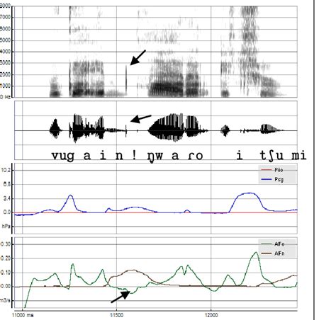 Spectrogram, audio waveform, intraoral pressure (Pio), oral (AFo) and... | Download Scientific ...