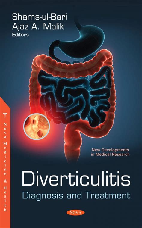 Diverticulitis: Diagnosis and Treatment – Nova Science Publishers