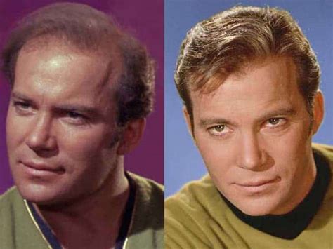 A Startling Fact About William Shatner Toupee | Laylahair