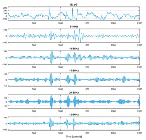 ECoG signals and signals after the application of the band-pass filters. | Download Scientific ...