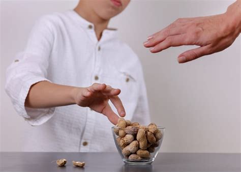 All you need to know about peanut allergies in kids | HoneyKids Asia