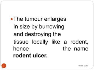 Rodent ulcer