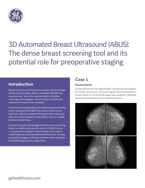 (PDF) 3D Automated Breast Ultrasound (ABUS): The dense breast ...