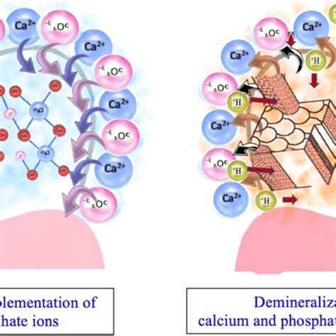 Process of remineralization and demineralization. Remineralization is a ...