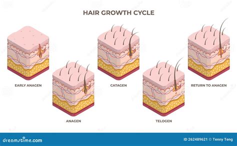 Isometric Hair Growth Cycle, Anagen, Telogen, Catagen Phases. Human Skin Layers With Hair ...