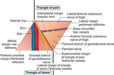 Laparoscopic Inguinal Hernia Surgery Anatomy