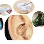 Home Remedies to Get Rid of Blackheads in Ears - Home Health Beauty Tips