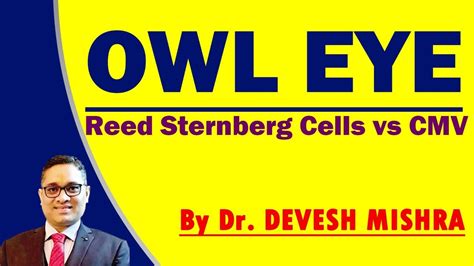 Owl Eye , Reed sternberg cells vs CMV Dr. Devesh Mishra - YouTube