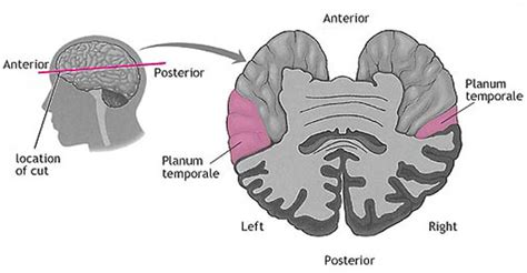 Faulty Wiring in Brain May Cause Stuttering | NOLA Brain and Behavior, LLC – Clinical, Forensic ...