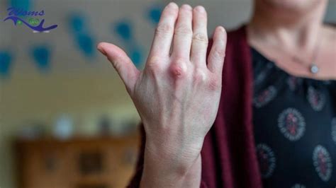 Burning hands: Is it a sign of health issues? - WOMS