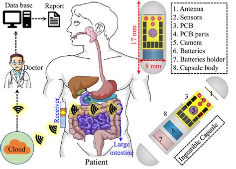 The concept of wireless patient monitoring system using ingestible ...